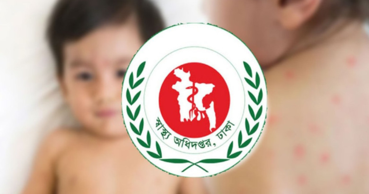 হাম পরিস্থিতি উদ্বেগজনক: ২৪ ঘণ্টায় আরও ১২ শিশুর মৃত্যু