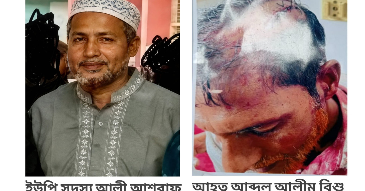 সলঙ্গায় আওয়ামিলীগ নেতার হামলায় বিএনপি নেতা আহত!